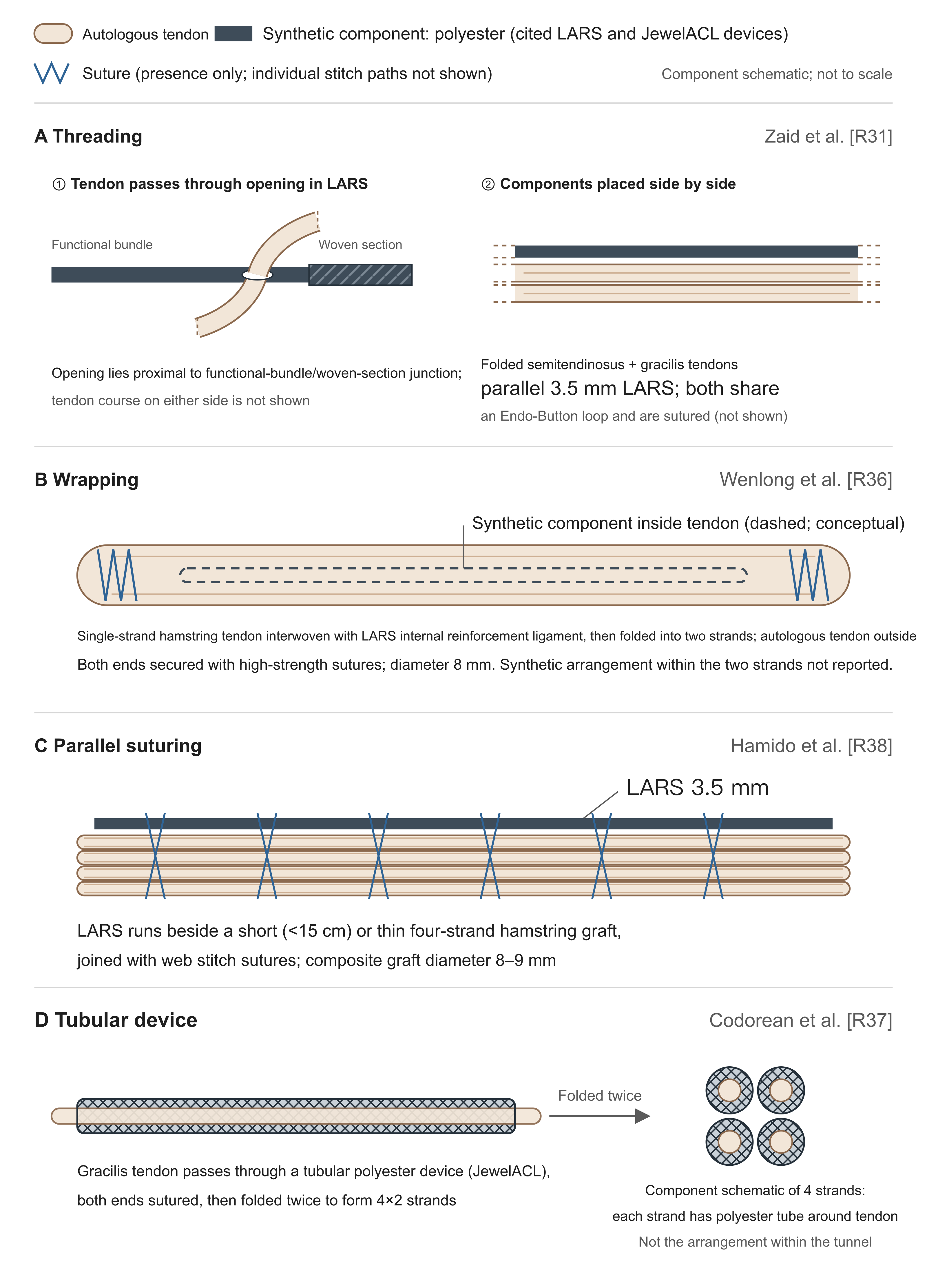 Four autograft–artificial composite configurations